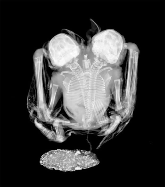 X光相片显示了蝙蝠连体婴两条汇合的脊椎。 PHOTOGRAPH BY LABORATÓRIO DE RADIOGRAFIAS, DIVIS&Ati