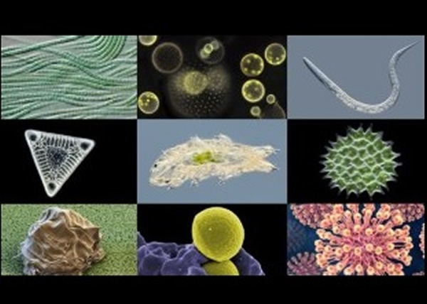 园长认为，微生物的重要性被低估。