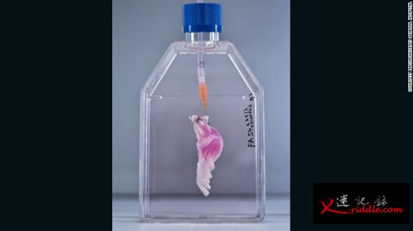 用一个细胞培养出一条手臂